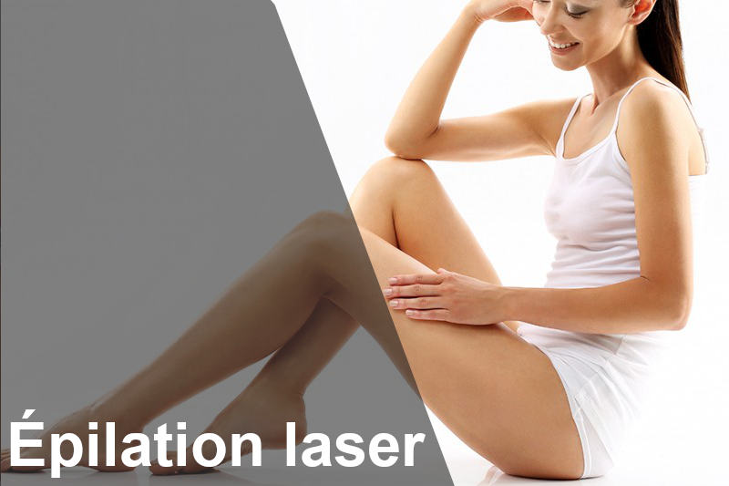 IDÉES REÇUES DE L’ÉPILATION LASER